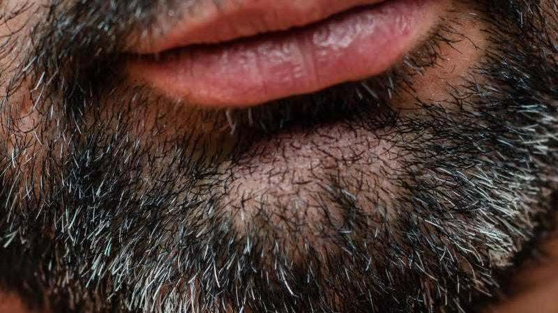 Poils blancs dans la barbe : comment s'en débarrasser.