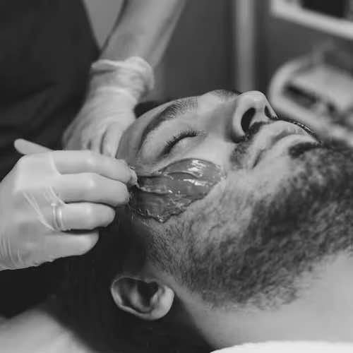 L'épilation de la barbe : pour un résultat durable.